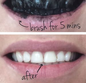  Poudre de blanchiment des dents à base de Charbon Naturel Miracle Teeth Whitener